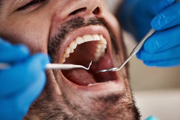 Best Emergency Dental Filling Replacement  in West Monroe, MI